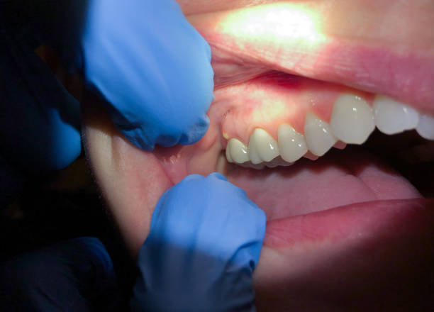 Best Emergency Care for Gum Disease in Kimball, TN