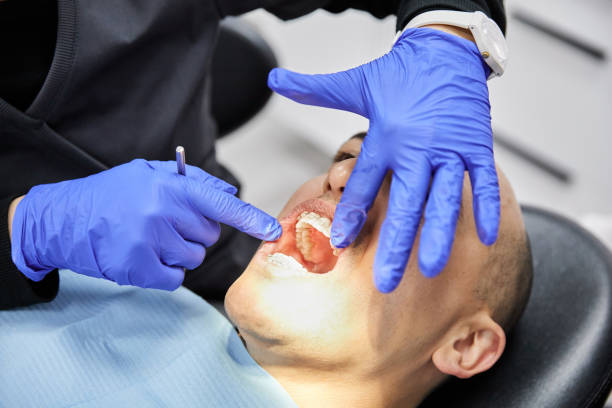 Best Knocked-Out Tooth (Avulsed Tooth) Treatment in Kimball, TN
